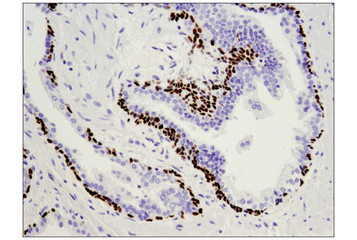 Immunohistochemistry Image 1: p63 (D9L7L) Rabbit Monoclonal Antibody (BSA and Azide Free)