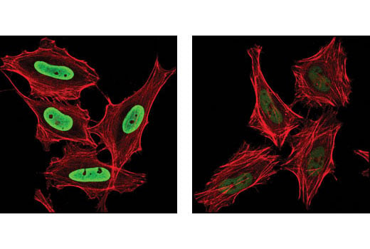 Immunofluorescence Image 1: Acetyl-Histone H3 (Lys9) (C5B11) Rabbit mAb (Alexa Fluor<sup>®</sup> 488 Conjugate)