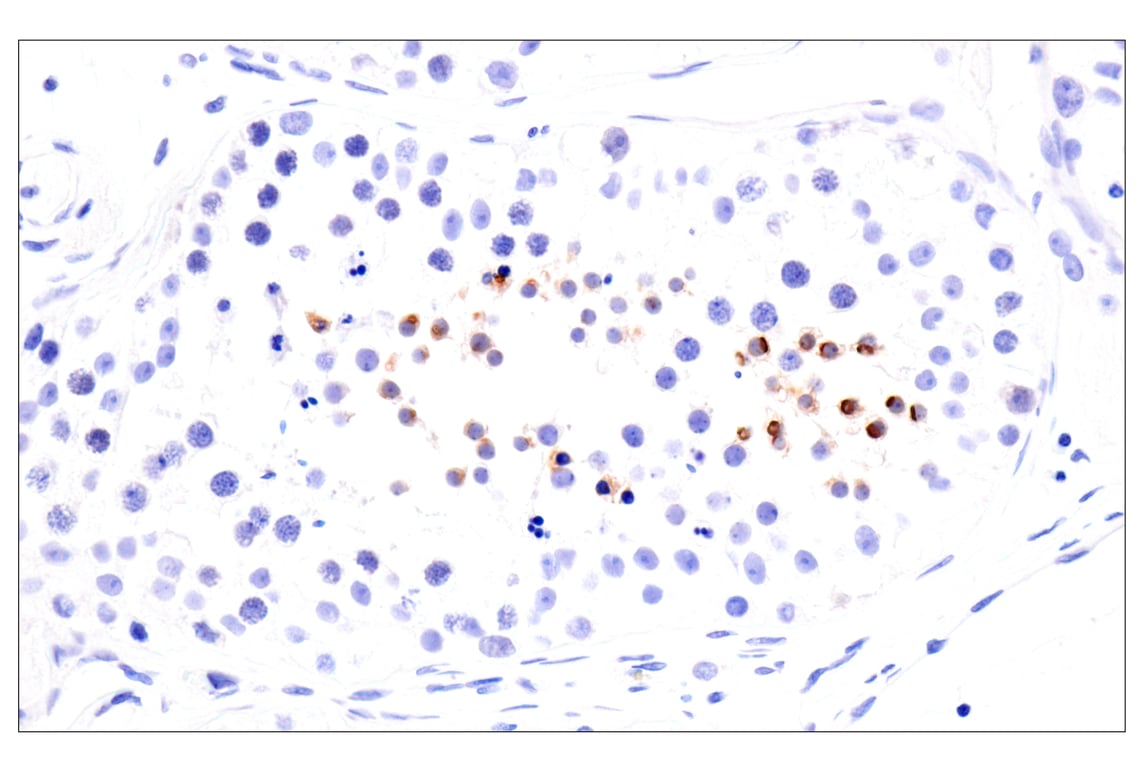 Immunohistochemistry Image 3: KISS1 (E6H9S) Rabbit Monoclonal Antibody