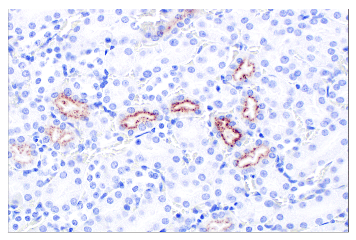 Immunohistochemistry Image 4: IGFBP2 (F3E6V) Rabbit Monoclonal Antibody
