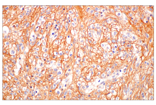 Immunohistochemistry Image 9: COL3A1 (E8D7R) Rabbit Monoclonal Antibody (BSA and Azide Free)