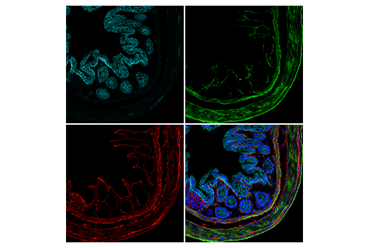 Immunofluorescence Image 3: COL1A1 (E8F4L) Rabbit Monoclonal Antibody (Alexa Fluor<sup>®</sup> 647 Conjugate)