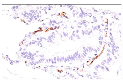Immunohistochemistry Image 1: IL3RA/CD123 (BR4MS) Mouse Monoclonal Antibody