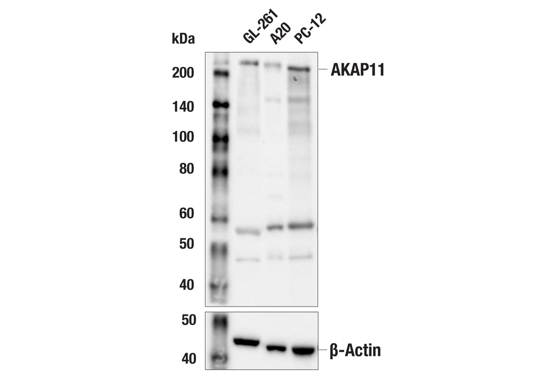 Western Blotting Image 2: AKAP11 (E9E6W) Rabbit Monoclonal Antibody