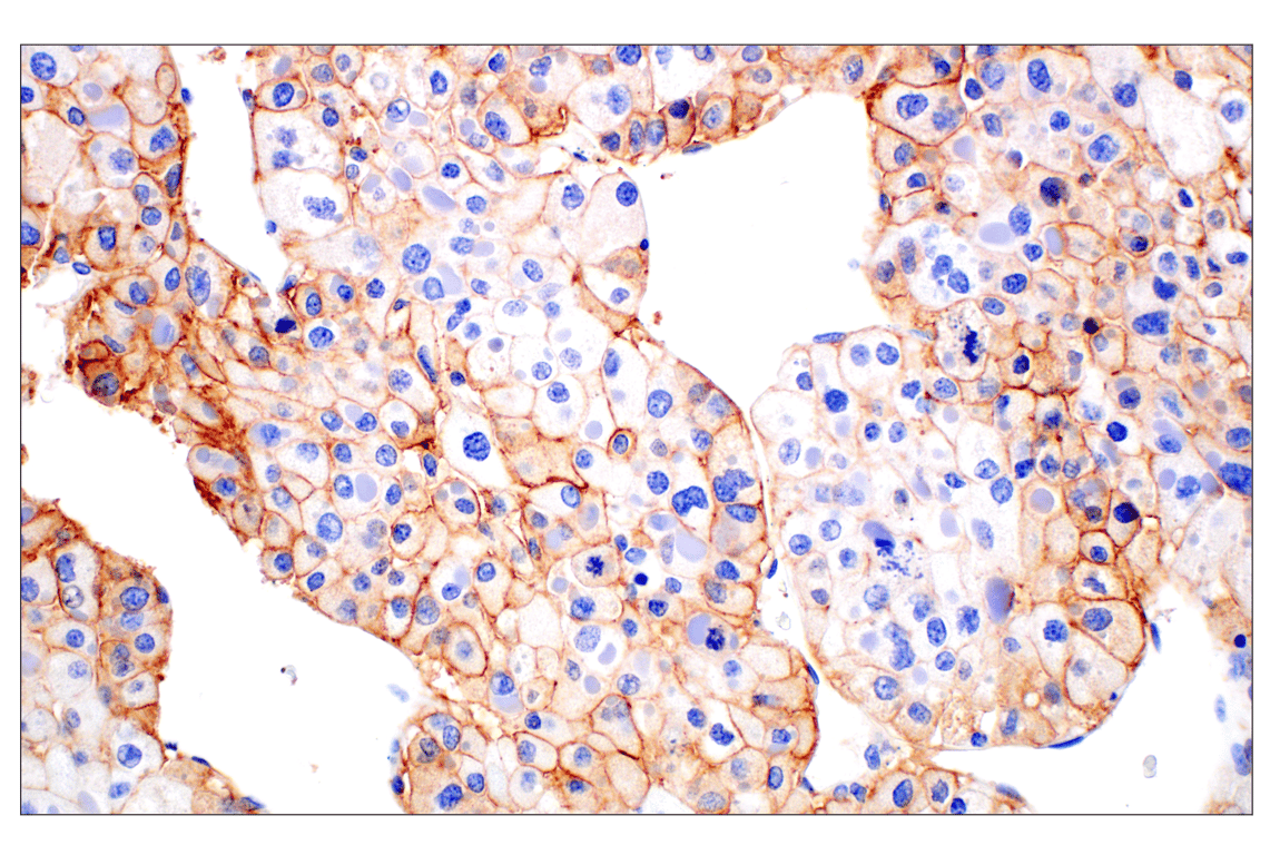 Immunohistochemistry Image 2: SCARB1 (E9H4F) Rabbit Monoclonal Antibody