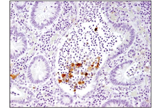 Immunohistochemistry Image 1: IL-1 beta (3A6) Mouse Monoclonal Antibody