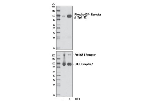 undefined Image 1: PhosphoPlus<sup>®</sup> IGF-I Receptor β Antibody Duet
