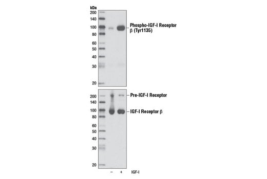 undefined Image 3: Phospho-Insulin/IGF Receptor Antibody Sampler Kit