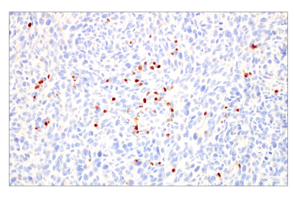 Immunohistochemistry Image 9: T-bet/TBX21 (E4I2K) Rabbit Monoclonal Antibody (BSA and Azide Free)