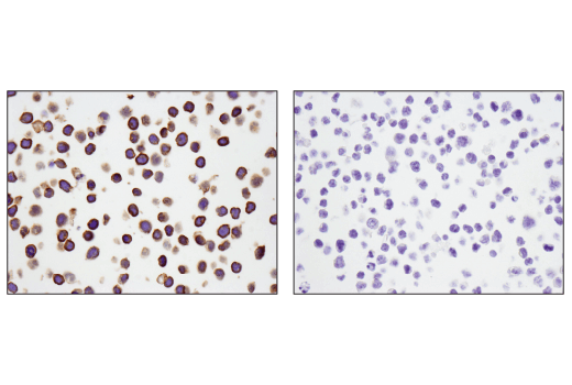 Immunohistochemistry Image 5: CD5 (E8X3S) Rabbit Monoclonal Antibody (BSA and Azide Free)