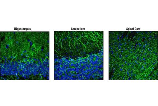 Immunofluorescence Image 1: MAP2 Antibody
