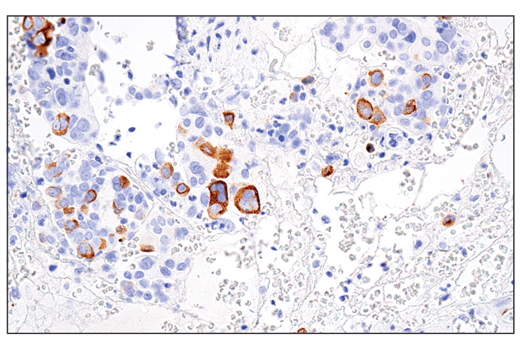Immunohistochemistry Image 2: RHAMM/CD168 (E7S4Y) Rabbit Monoclonal Antibody (BSA and Azide Free)