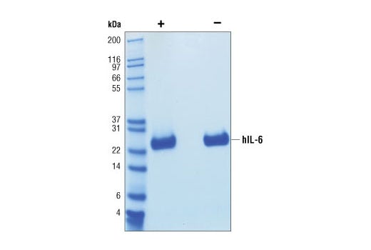 undefined Image 3: Human Interleukin-6 (hIL-6)