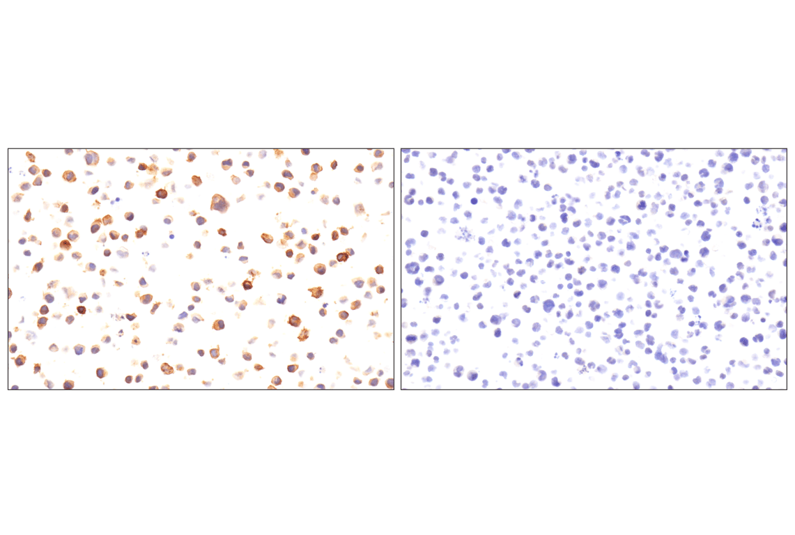 Immunohistochemistry Image 8: SLC40A1/Ferroportin-1 (F9U5S) Rabbit Monoclonal Antibody