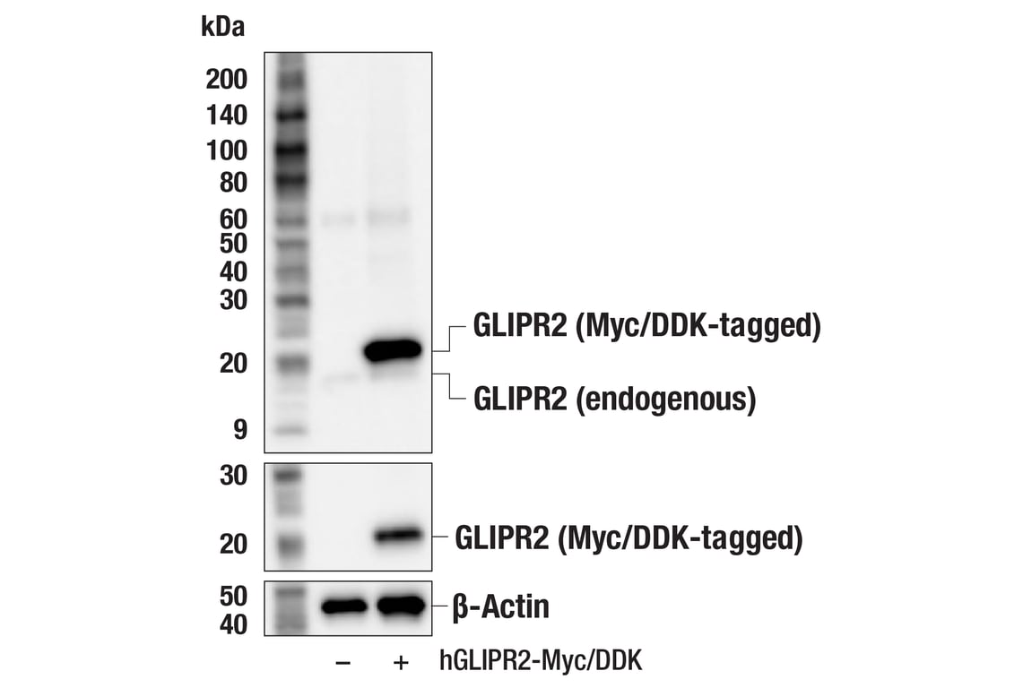 Western Blotting Image 3: GLIPR2 (F7H7V) Rabbit Monoclonal Antibody