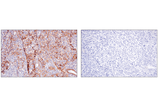 Immunohistochemistry Image 4: CD151 (E4I9J) Rabbit Monoclonal Antibody