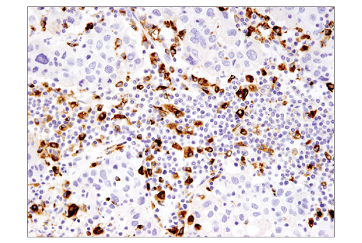 Immunohistochemistry Image 3: CD68 (D4B9C) XP<sup>®</sup> Rabbit mAb (BSA and Azide Free)