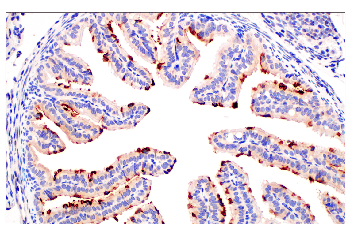 Immunohistochemistry Image 6: CD10/Neprilysin (F4P6H) Rabbit Monoclonal Antibody (BSA and Azide Free)