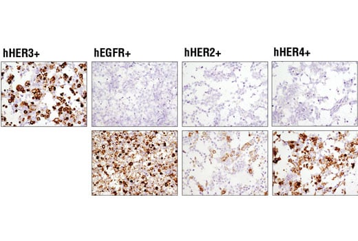 Immunohistochemistry Image 4: HER3/ErbB3 (D22C5) Rabbit Monoclonal Antibody