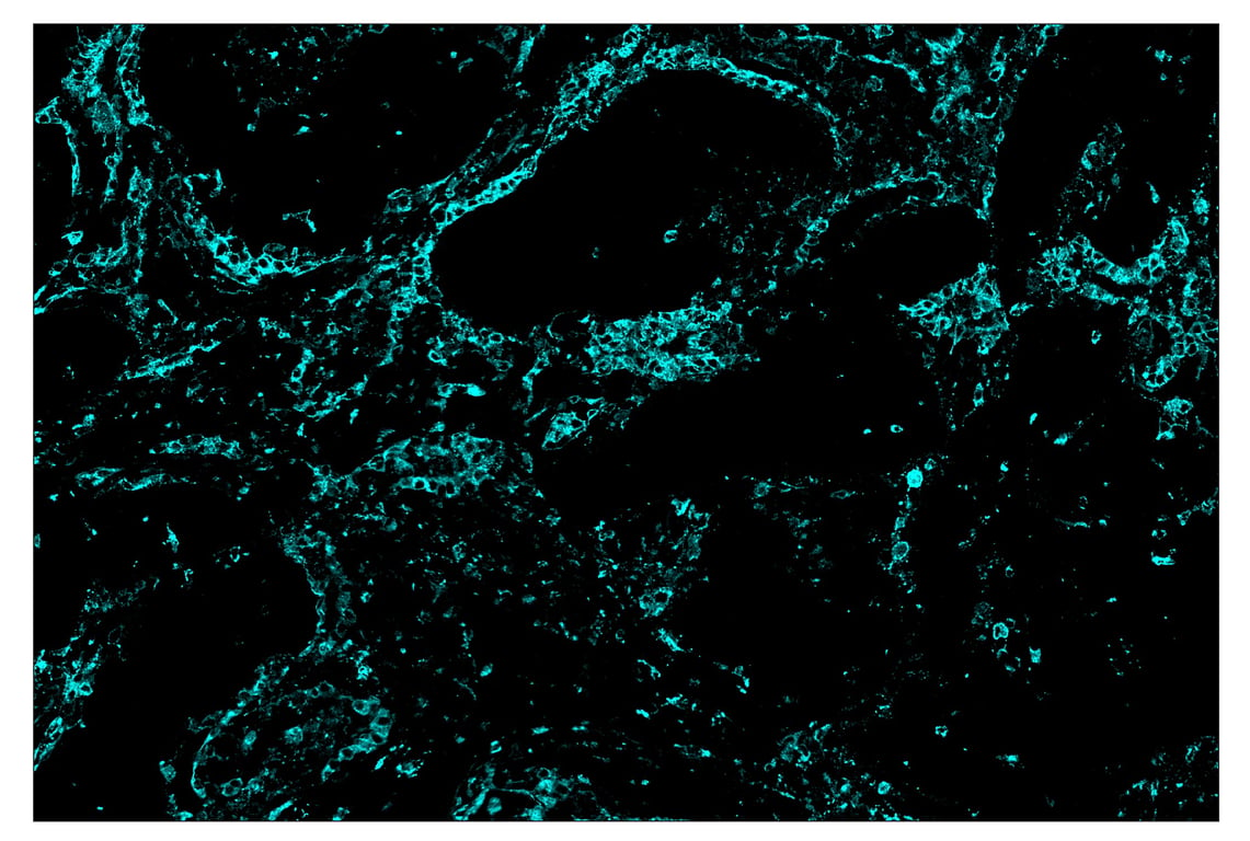 Immunohistochemistry Image 5: HLA-DRA (E9R2Q) & CO-0023-647 SignalStar<sup>™</sup> Oligo-Antibody Pair