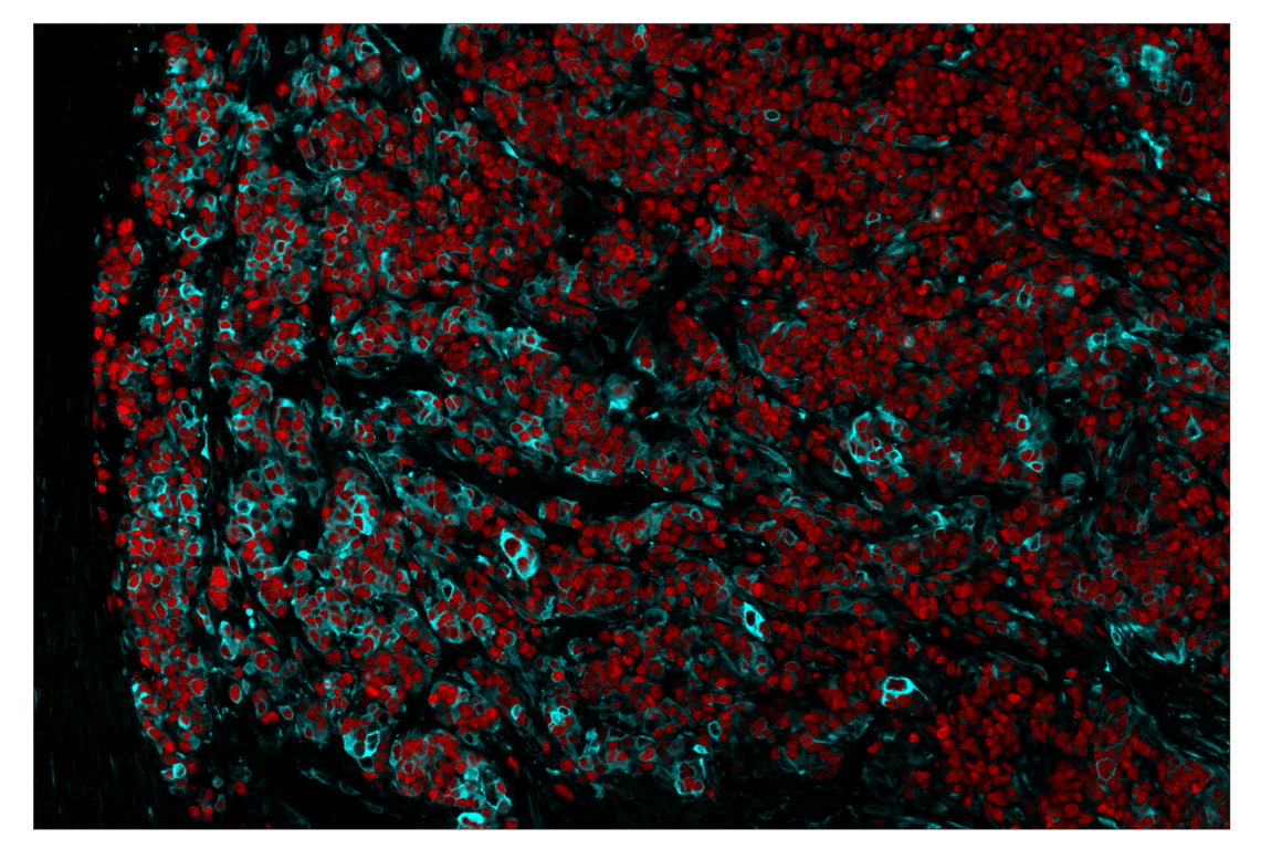 Immunohistochemistry Image 1: Olig2 (E6G6Q) & CO-0124-594 SignalStar<sup>™</sup> Oligo-Antibody Pair