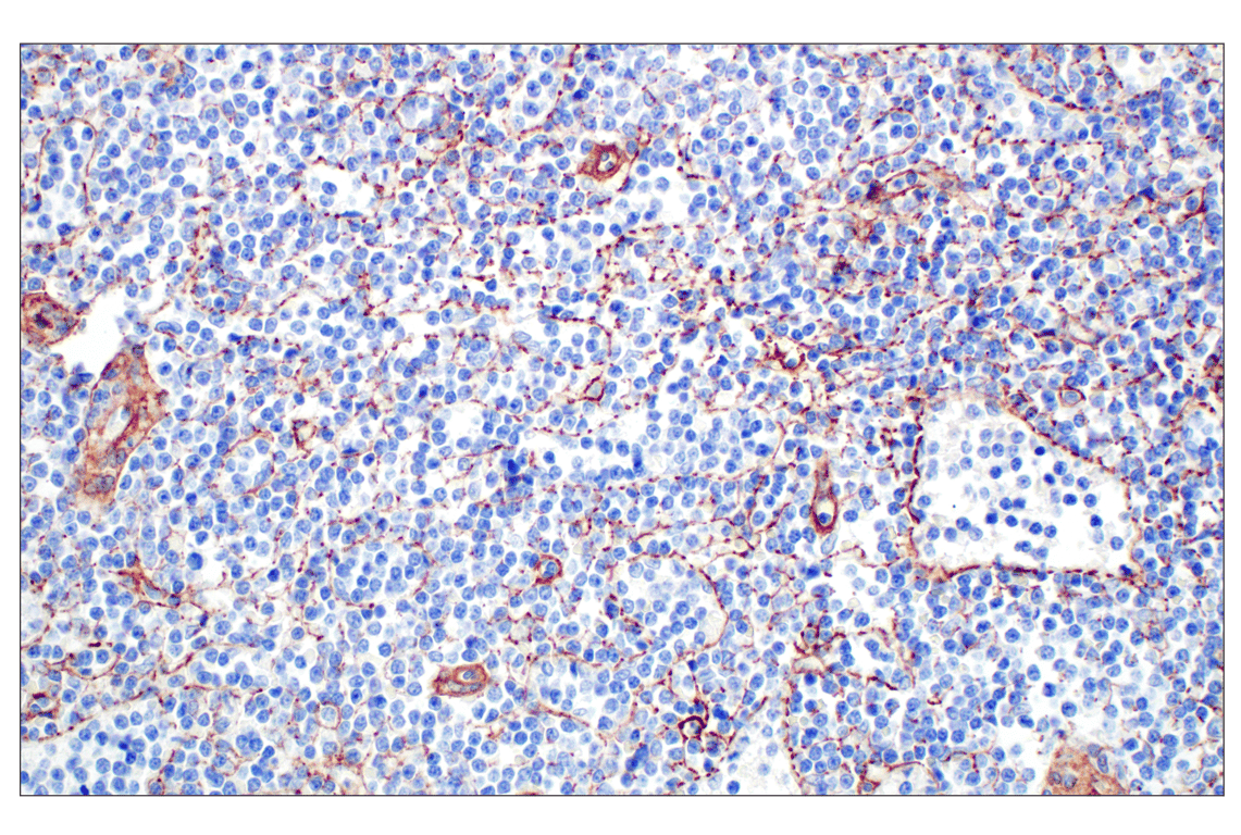Immunohistochemistry Image 3: COL4A1 (E5M6R) Rabbit Monoclonal Antibody (BSA and Azide Free)
