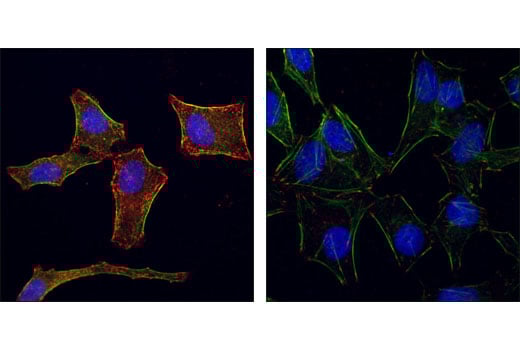 Immunofluorescence Image 2: Phospho-Tyrosine Mouse Monoclonal Antibody (P-Tyr-100) (BSA and Azide Free)