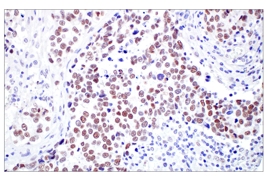 Immunohistochemistry Image 4: TIF1 alpha/TRIM24 (E9T3N) Rabbit Monoclonal Antibody