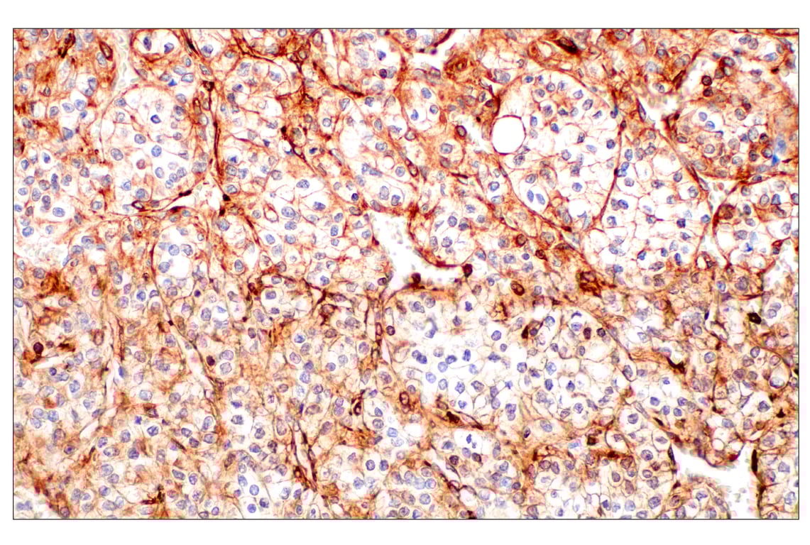 Immunohistochemistry Image 3: Filamin A (E8P8M) Rabbit Monoclonal Antibody
