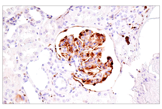 undefined Image 27: Genetics of Parkinson's Disease: Lysosomal Dysfunction Antibody Sampler Kit