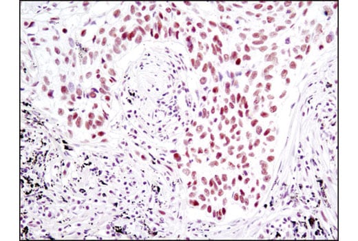 Immunohistochemistry Image 1: SP1 (D4C3) Rabbit Monoclonal Antibody (BSA and Azide Free)