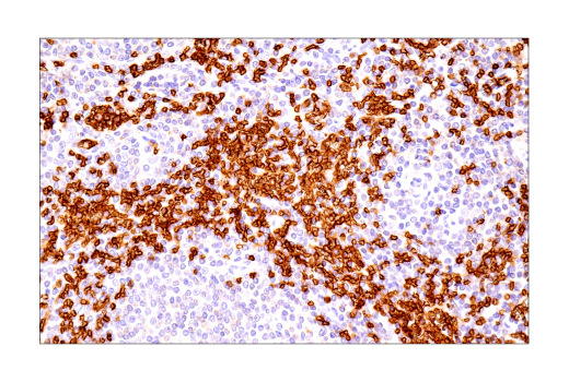 Immunohistochemistry Image 8: Glut1 (IHC404) Mouse Monoclonal Antibody
