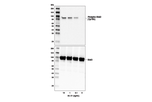 undefined Image 3: Human Interleukin-21 (hIL-21) Recombinant Protein