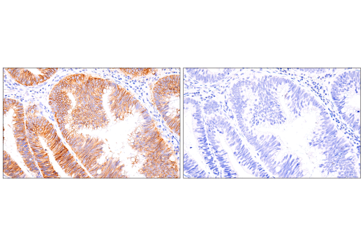 Immunohistochemistry Image 3: DOG1/Anoctamin 1 (K9) Mouse Monoclonal Antibody