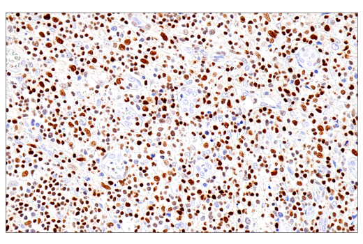 Immunohistochemistry Image 2: RUNX3/AML2 (E8D5W) Rabbit Monoclonal Antibody