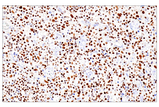 Immunohistochemistry Image 2: RUNX3/AML2 (E8D5W) XP<sup>®</sup> Rabbit mAb