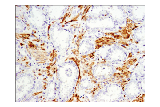 Immunohistochemistry Image 3: OX40L (D6K7R) Rabbit Monoclonal Antibody (BSA and Azide Free)