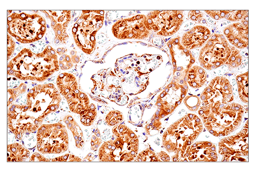 Immunohistochemistry Image 3: PDI (E7O2R) Mouse Monoclonal Antibody