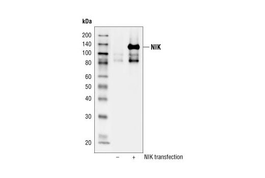 undefined Image 16: NF-kappaB Non-Canonical Pathway Antibody Sampler Kit