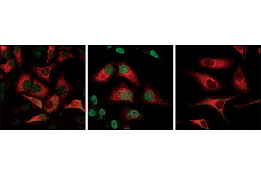 Immunofluorescence Image 1: Phospho-Stat1 (Ser727) Antibody