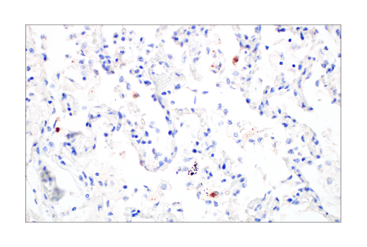 Immunohistochemistry Image 1: SARS-CoV-2 Nucleocapsid Protein (E8R1L) Mouse Monoclonal Antibody