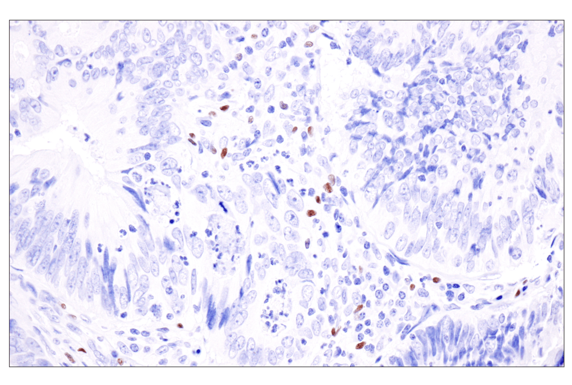 Immunohistochemistry Image 5: FoxP3 (221D) Mouse Monoclonal Antibody