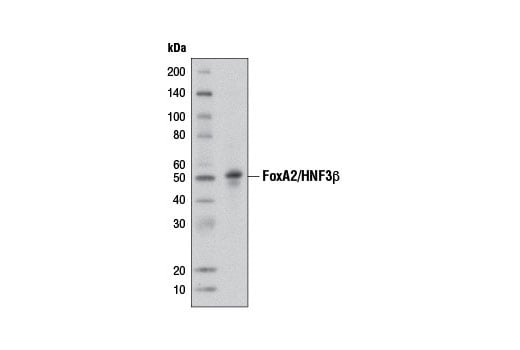 Western Blotting Image 1: FoxA2/HNF3β (D56D6) XP<sup>®</sup> Rabbit mAb