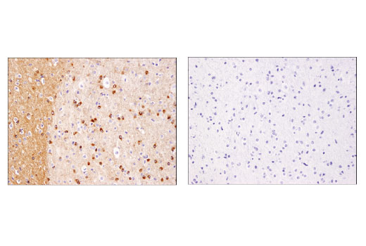 Immunohistochemistry Image 1: Phospho-Tau (Ser416) (D7U2P) Rabbit Monoclonal Antibody (BSA and Azide Free)