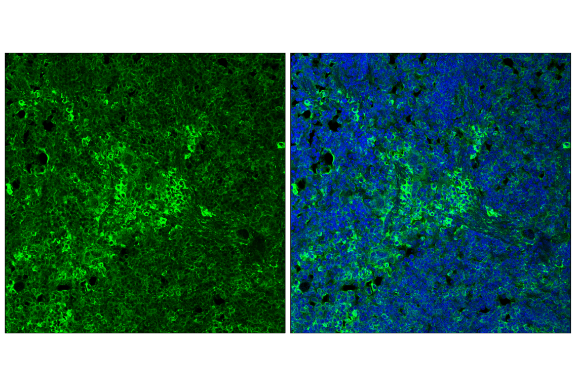 undefined Image 28: ER Stress Antibody Sampler Kit