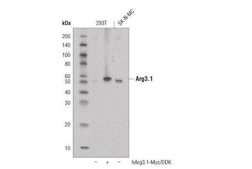 Western Blotting Image 1: Arg3.1 (D6H9N) Rabbit mAb