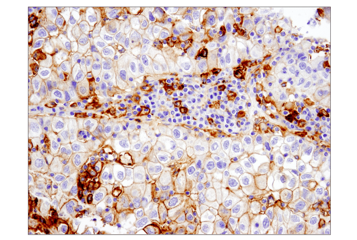 Immunohistochemistry Image 1: PD-L1 (E1L3N) Rabbit Monoclonal Antibody