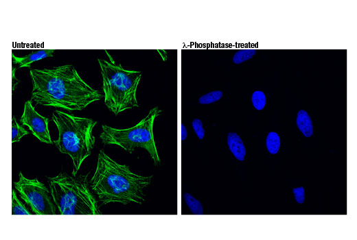 Phospho-Myosin IIa (Ser1943) (D7Z7T) Rabbit mAb | Cell