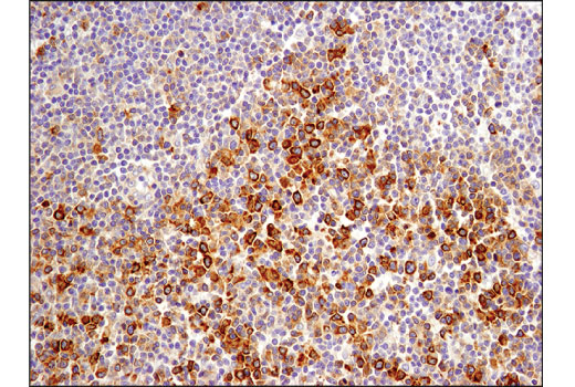 Immunohistochemistry Image 3: Phospho-CAD (Ser1859) (D5K5W) Rabbit Monoclonal Antibody
