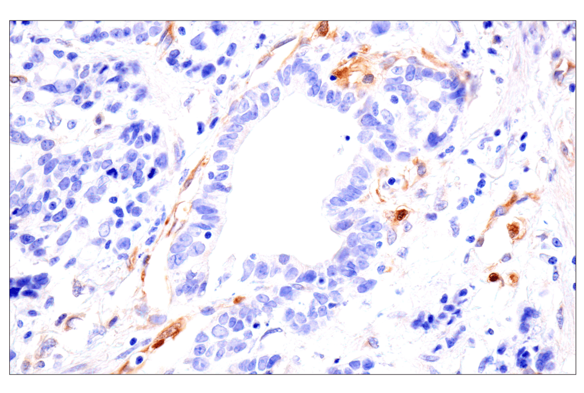 Immunohistochemistry Image 5: FAK (F7Z4C) Mouse Monoclonal Antibody (BSA and Azide Free)